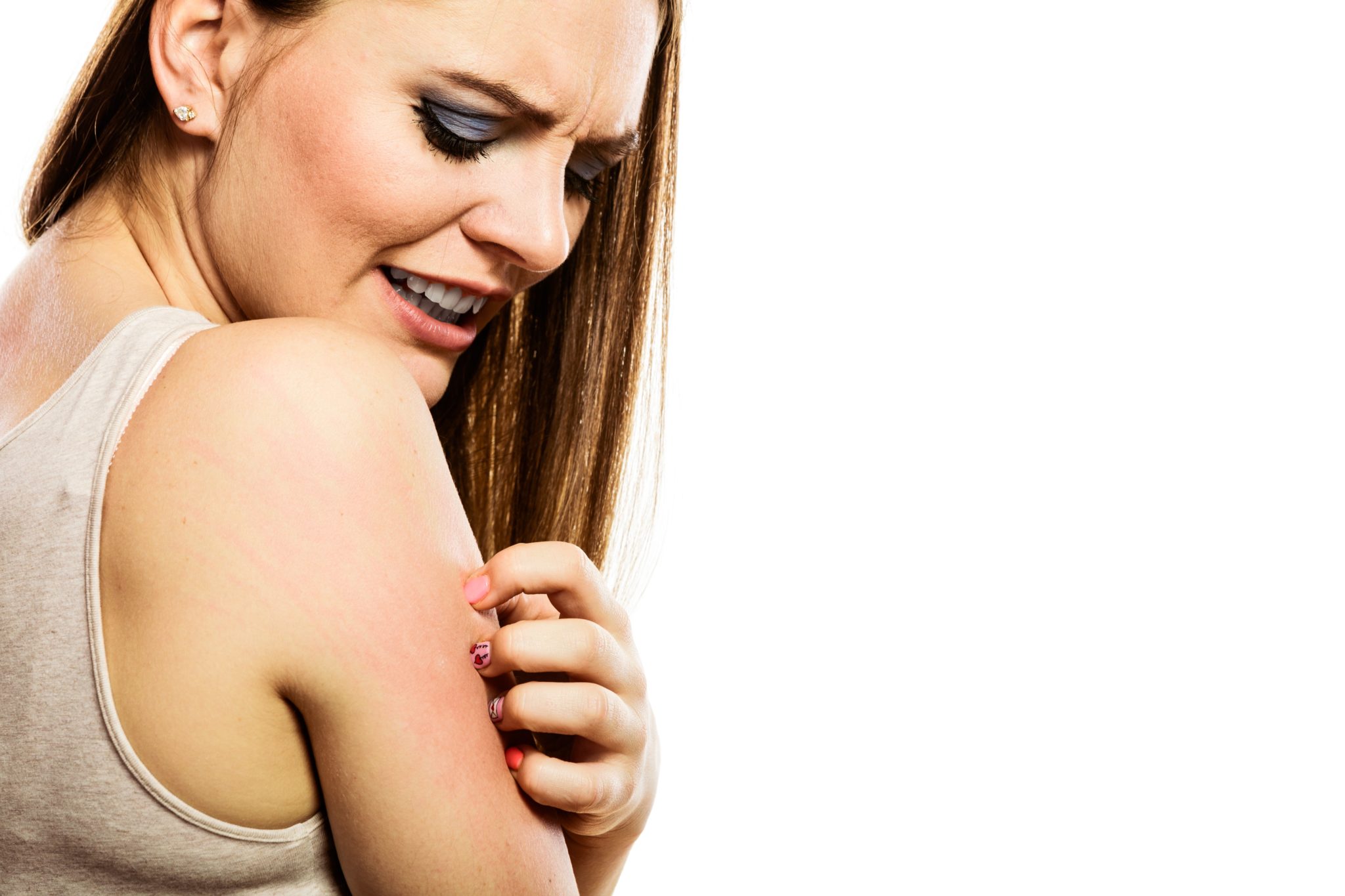 How To Treat Winter Itch